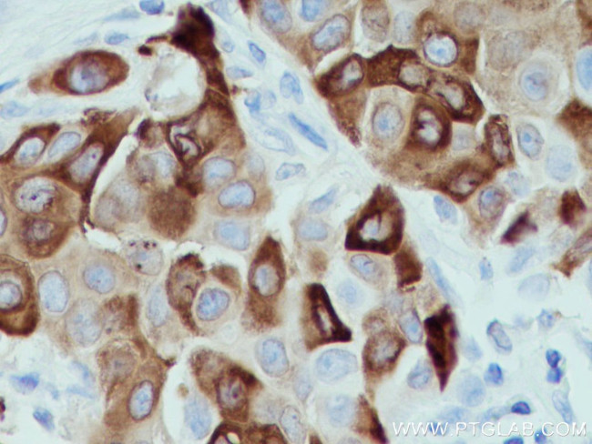 AGR2 Antibody in Immunohistochemistry (Paraffin) (IHC (P))