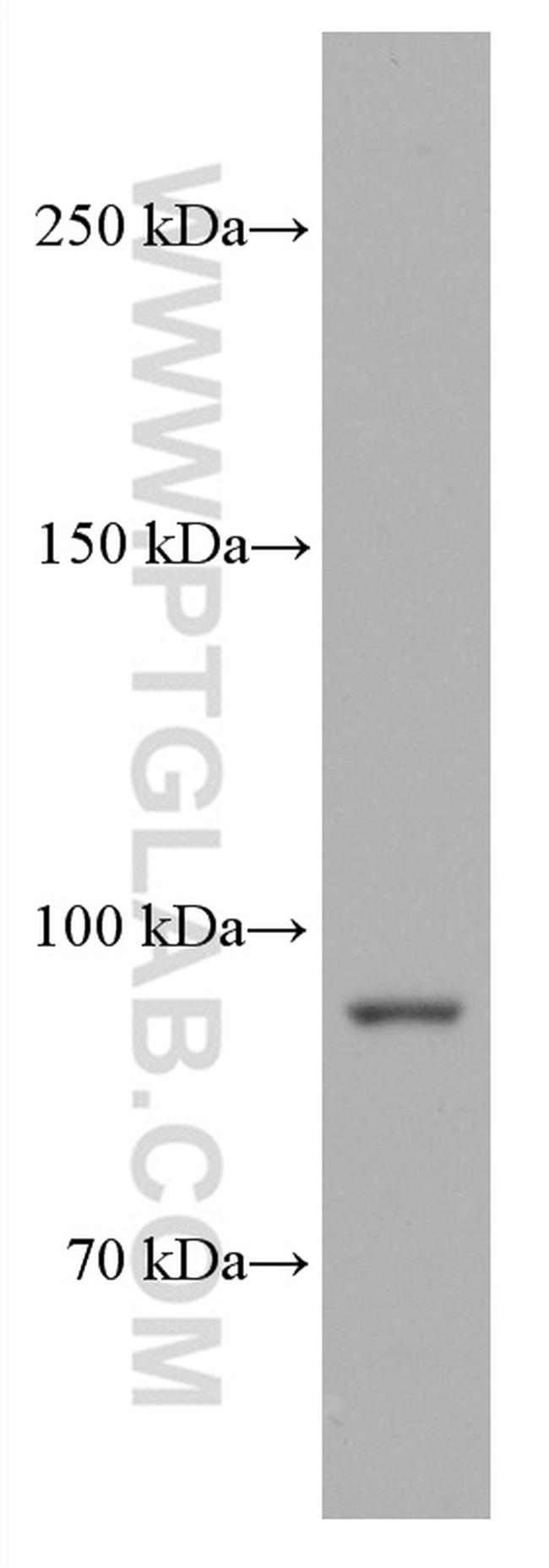 PYGL Antibody in Western Blot (WB)