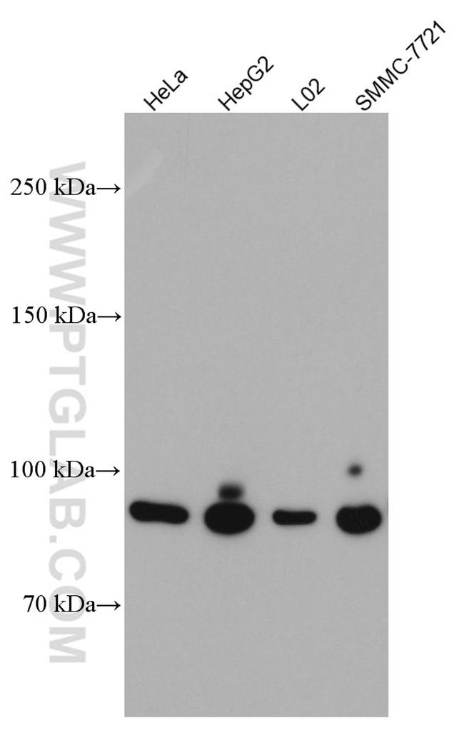 PYGL Antibody in Western Blot (WB)