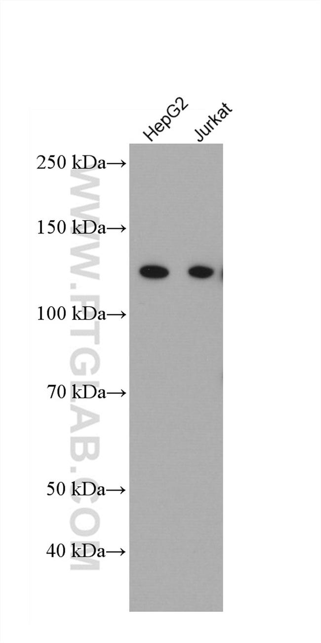 IFIH1 Antibody in Western Blot (WB)