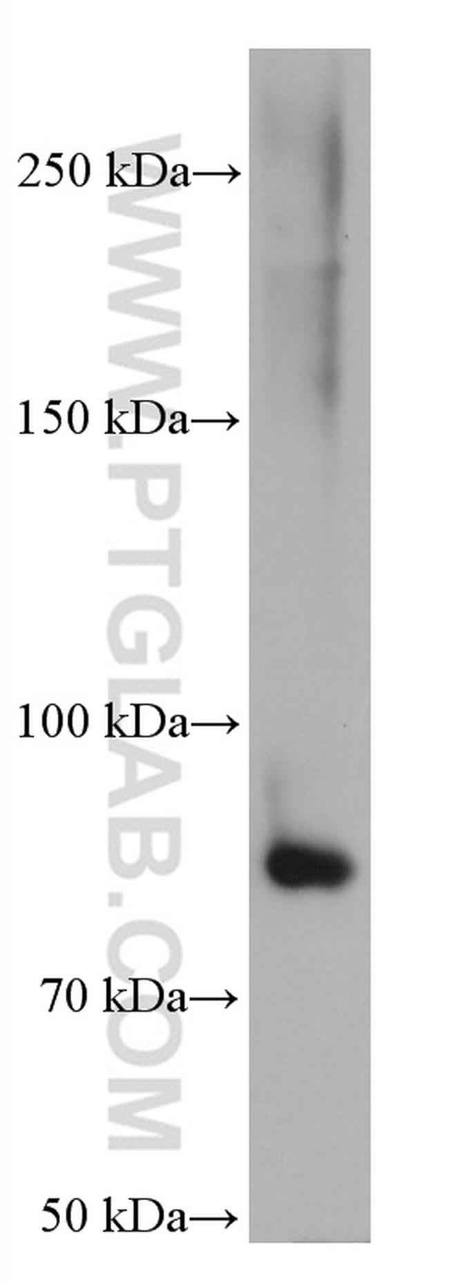 KCNQ2 Antibody in Western Blot (WB)