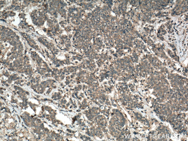 Syntaxin 16 Antibody in Immunohistochemistry (Paraffin) (IHC (P))