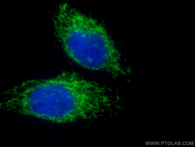 MFN1 Antibody in Immunocytochemistry (ICC/IF)