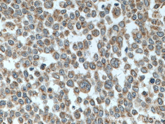 MFN1 Antibody in Immunohistochemistry (Paraffin) (IHC (P))