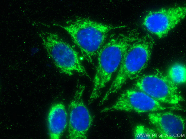 TOM20 Antibody in Immunocytochemistry (ICC/IF)