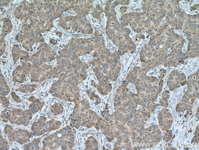 TOM20 Antibody in Immunohistochemistry (Paraffin) (IHC (P))