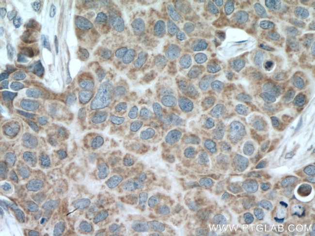 TOM20 Antibody in Immunohistochemistry (Paraffin) (IHC (P))