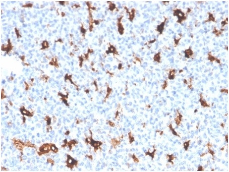 SPARC/Osteonectin Antibody in Immunohistochemistry (Paraffin) (IHC (P))