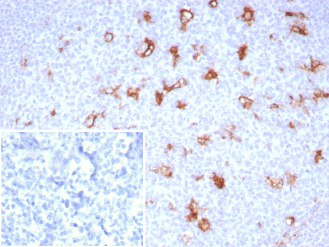 SPARC/Osteonectin Antibody in Immunohistochemistry (Paraffin) (IHC (P))