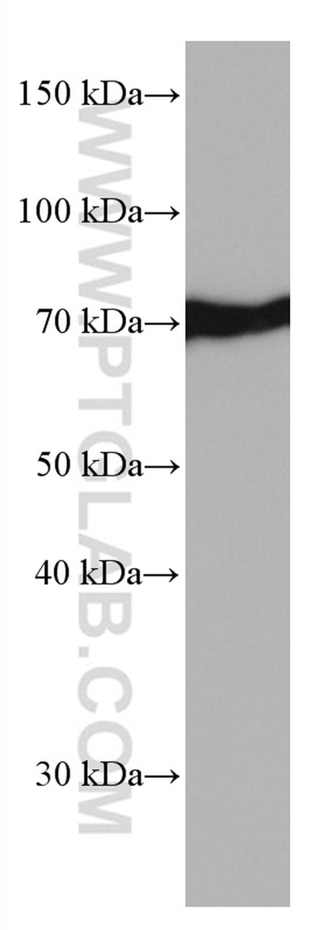 HSPA1L Antibody in Western Blot (WB)