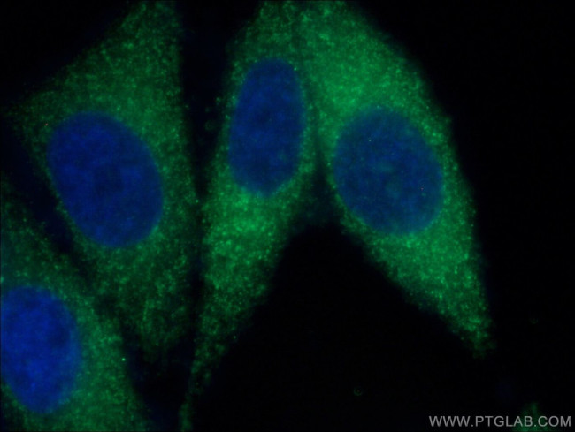 LACTB Antibody in Immunocytochemistry (ICC/IF)