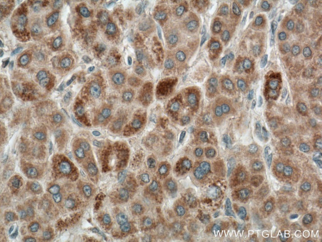 LACTB Antibody in Immunohistochemistry (Paraffin) (IHC (P))