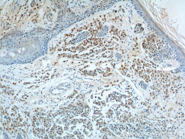 SOX10 Antibody in Immunohistochemistry (Paraffin) (IHC (P))