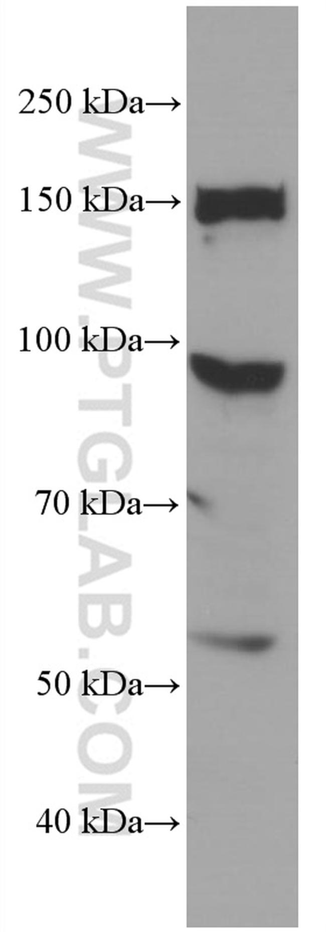 CFP Antibody in Western Blot (WB)