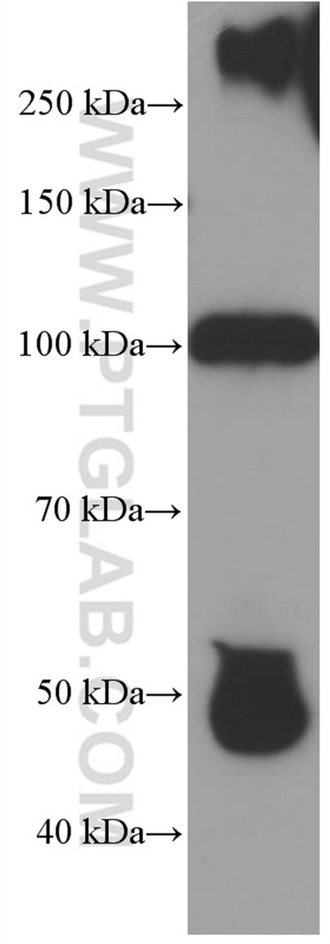 CFP Antibody in Western Blot (WB)