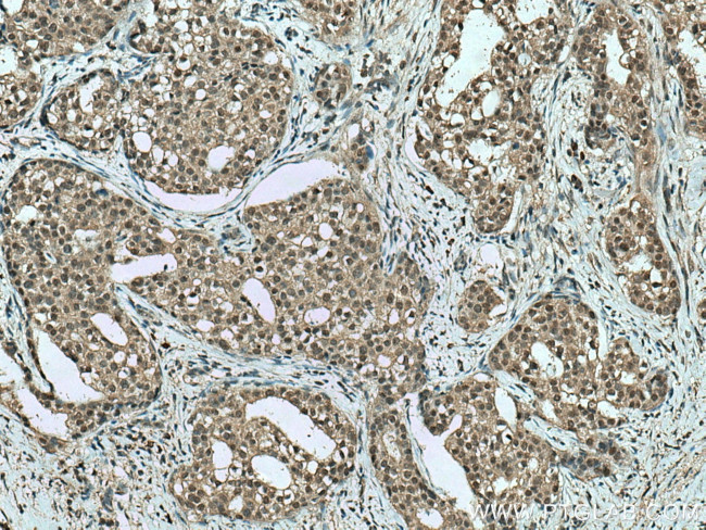 TRBP Antibody in Immunohistochemistry (Paraffin) (IHC (P))