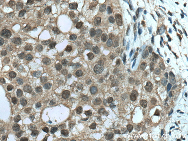 TRBP Antibody in Immunohistochemistry (Paraffin) (IHC (P))