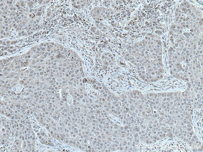 TRBP Antibody in Immunohistochemistry (Paraffin) (IHC (P))