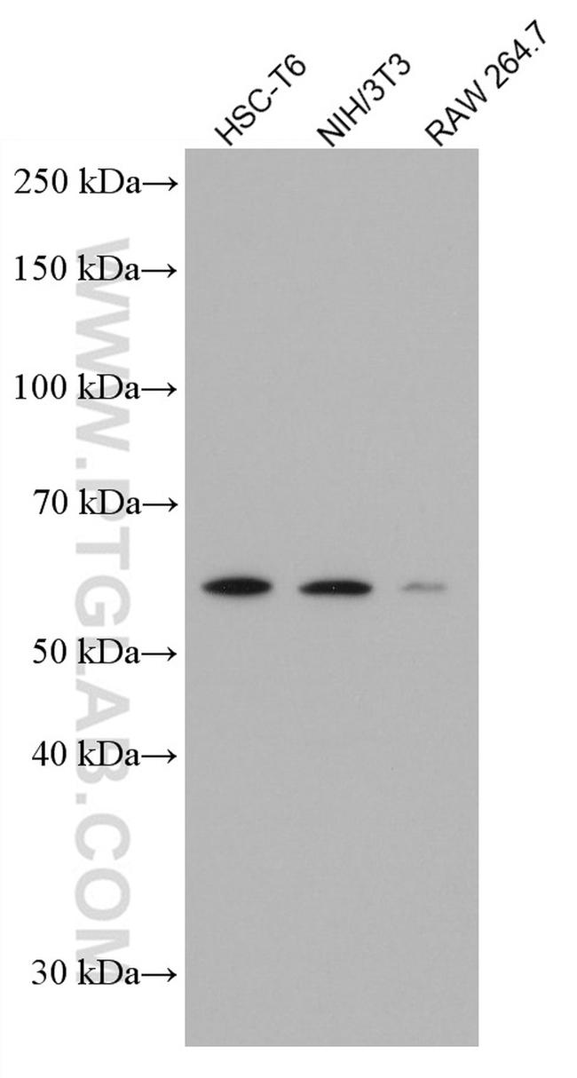 p57Kip2 Antibody in Western Blot (WB)