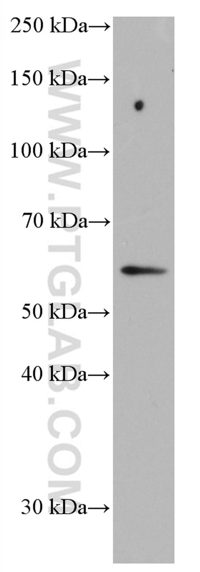 p57Kip2 Antibody in Western Blot (WB)