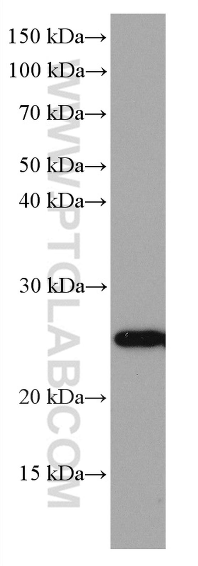 SOCS3 Antibody in Western Blot (WB)