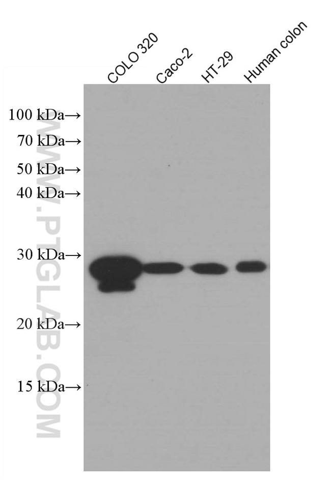 HPGD Antibody in Western Blot (WB)