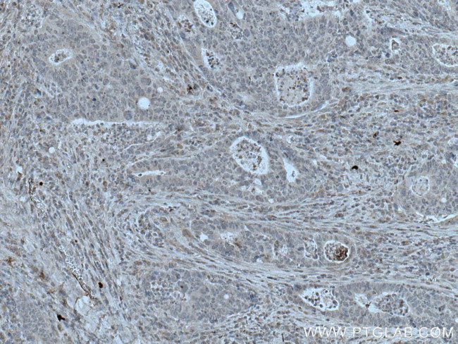 HPGD Antibody in Immunohistochemistry (Paraffin) (IHC (P))