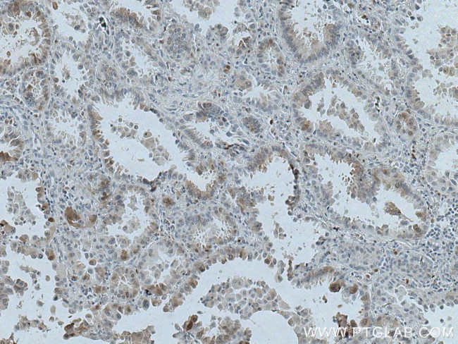 HPGD Antibody in Immunohistochemistry (Paraffin) (IHC (P))