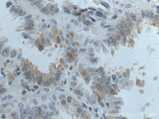 HPGD Antibody in Immunohistochemistry (Paraffin) (IHC (P))