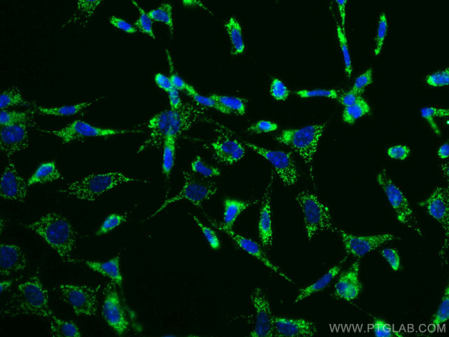 Bcl2 Antibody in Immunocytochemistry (ICC/IF)