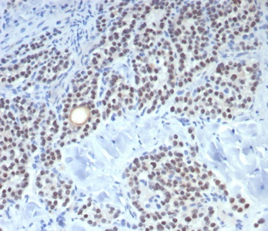 FOXL2 Antibody in Immunohistochemistry (Paraffin) (IHC (P))