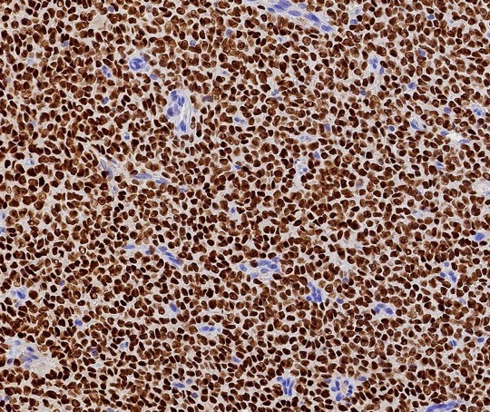 FOXL2 Antibody in Immunohistochemistry (Paraffin) (IHC (P))