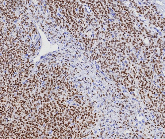 FOXL2 Antibody in Immunohistochemistry (Paraffin) (IHC (P))