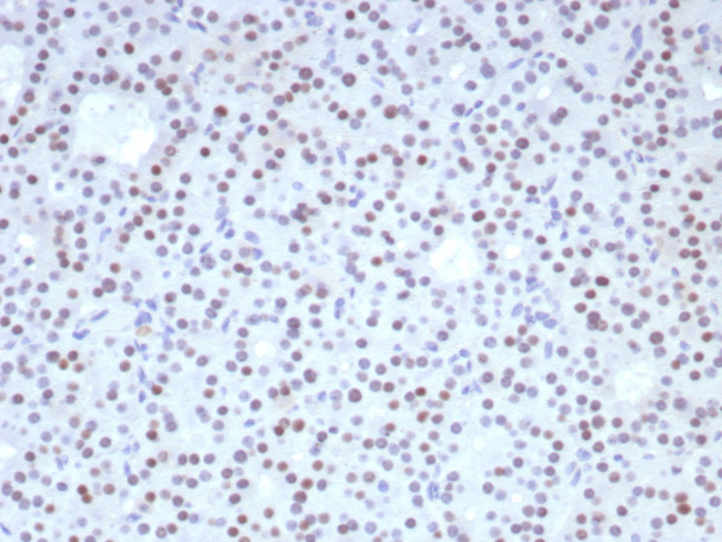 FOXL2 Antibody in Immunohistochemistry (Paraffin) (IHC (P))