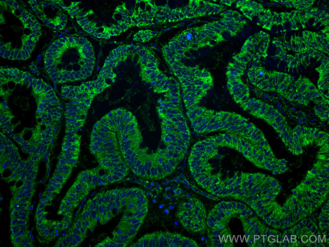 XIAP Antibody in Immunohistochemistry (PFA fixed) (IHC (PFA))