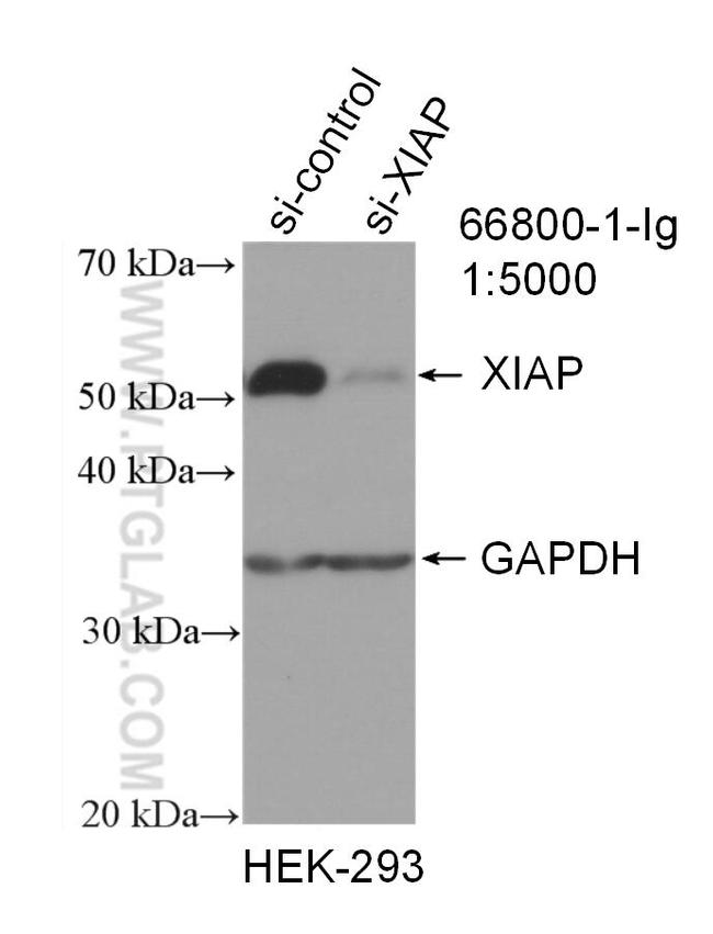 XIAP Antibody in Western Blot (WB)