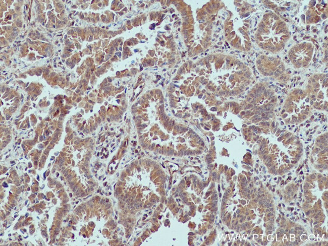 XIAP Antibody in Immunohistochemistry (Paraffin) (IHC (P))