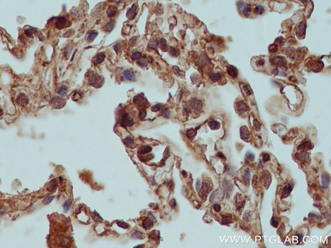 XIAP Antibody in Immunohistochemistry (Paraffin) (IHC (P))