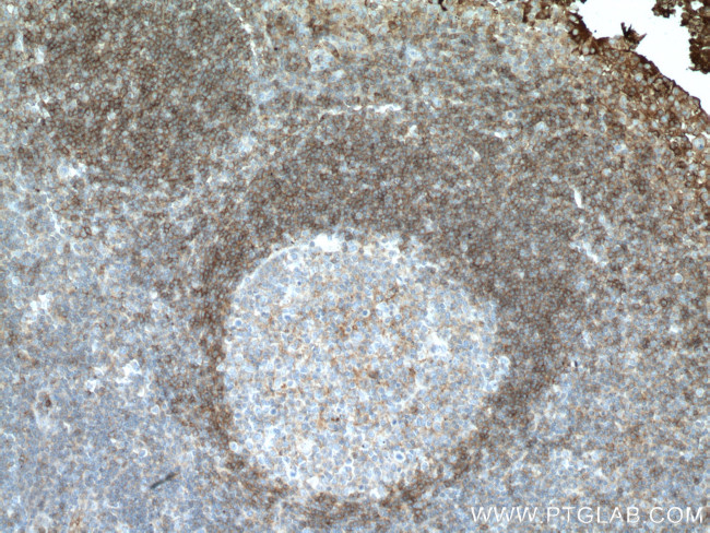 CCR6 Antibody in Immunohistochemistry (Paraffin) (IHC (P))