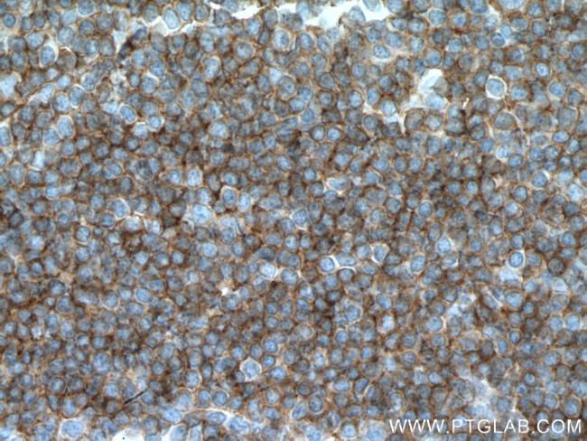 CCR6 Antibody in Immunohistochemistry (Paraffin) (IHC (P))