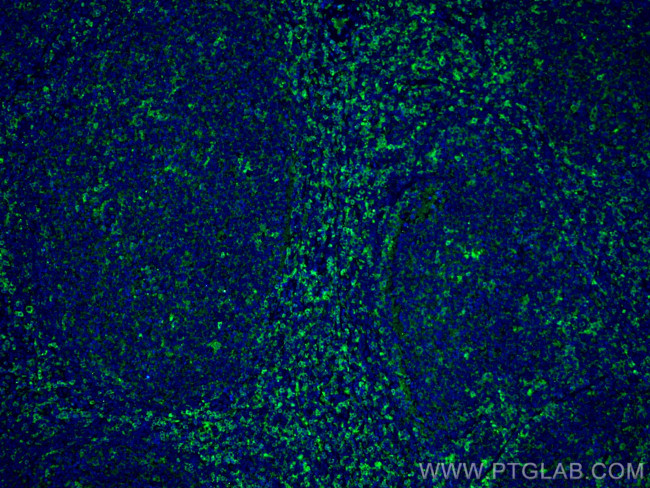 CCR6 Antibody in Immunohistochemistry (PFA fixed) (IHC (PFA))