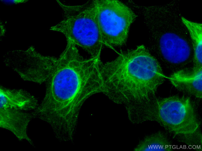 Cytokeratin 16 Antibody in Immunocytochemistry (ICC/IF)