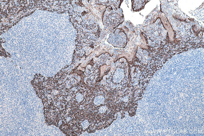 Cytokeratin 16 Antibody in Immunohistochemistry (Paraffin) (IHC (P))