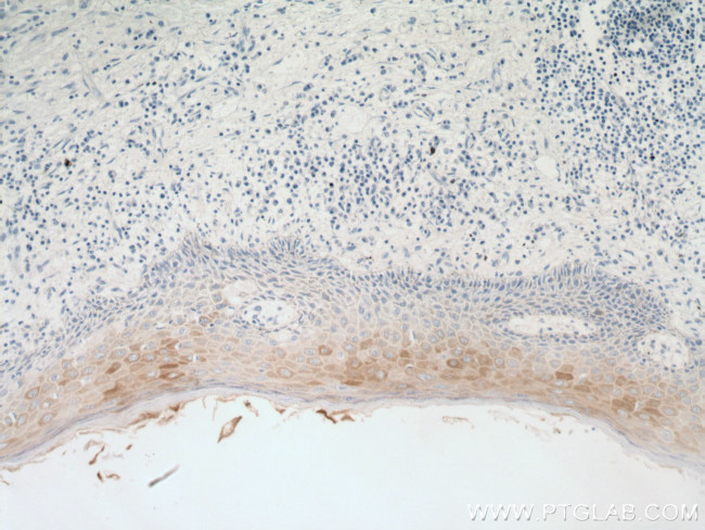 Cytokeratin 16 Antibody in Immunohistochemistry (Paraffin) (IHC (P))