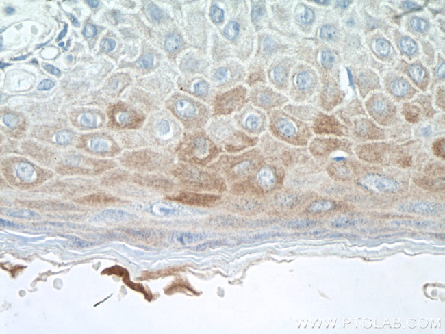 Cytokeratin 16 Antibody in Immunohistochemistry (Paraffin) (IHC (P))