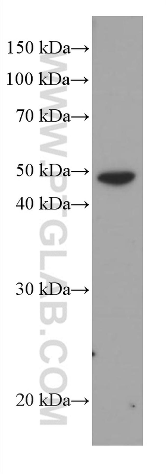 Cytokeratin 16 Antibody in Western Blot (WB)