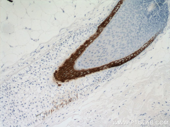 Cytokeratin 16 Antibody in Immunohistochemistry (Paraffin) (IHC (P))