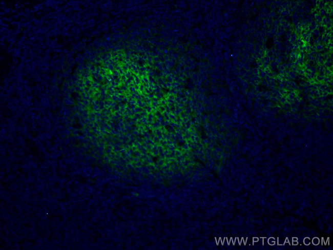 CD82 Antibody in Immunohistochemistry (PFA fixed) (IHC (PFA))