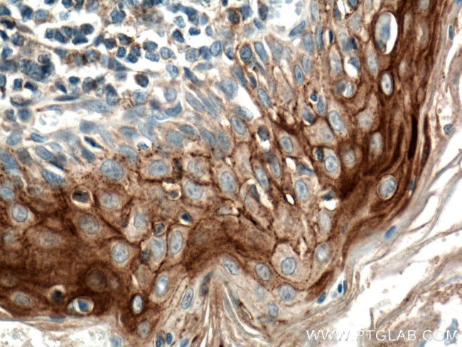 CD82 Antibody in Immunohistochemistry (Paraffin) (IHC (P))