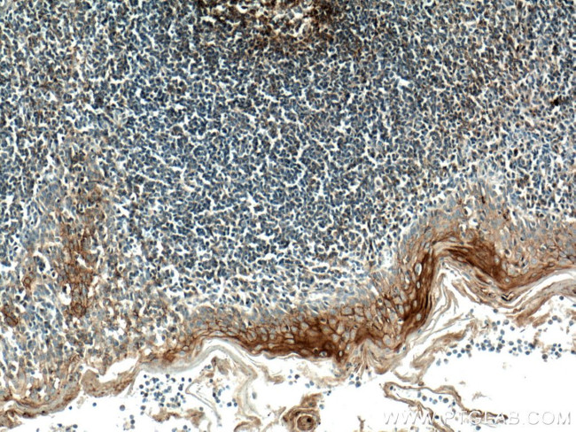 CD82 Antibody in Immunohistochemistry (Paraffin) (IHC (P))